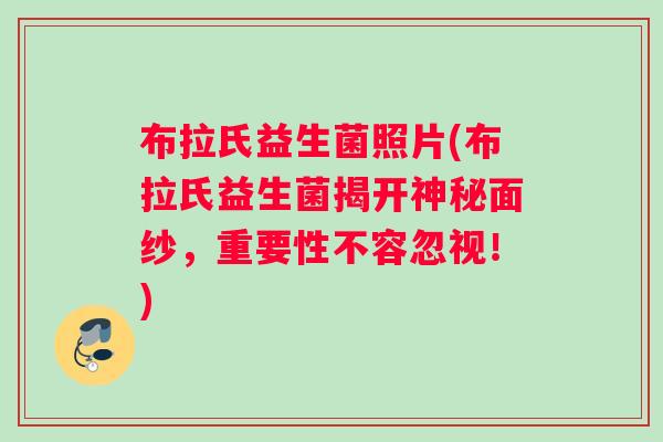 布拉氏益生菌照片(布拉氏益生菌揭开神秘面纱，重要性不容忽视！)